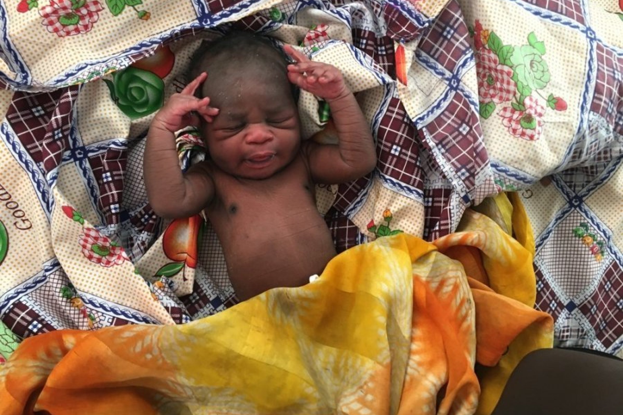 This little boy was born in the MSF hospital in Bentiu, South Sudan