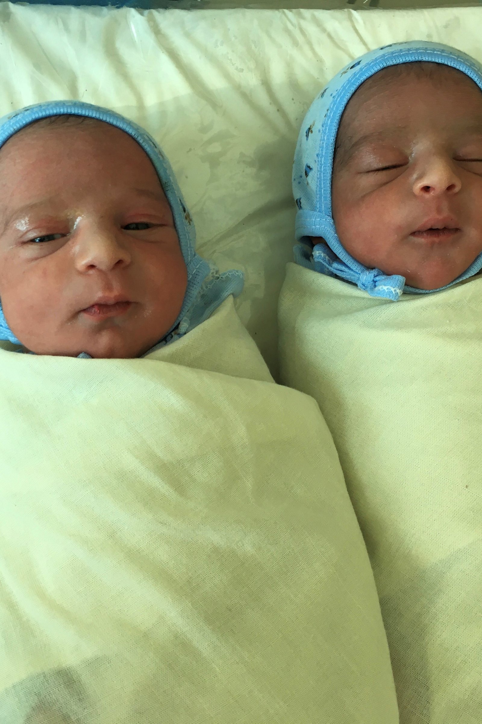 Newborn twins Ayman and Ayman, born in Houban, Yemen